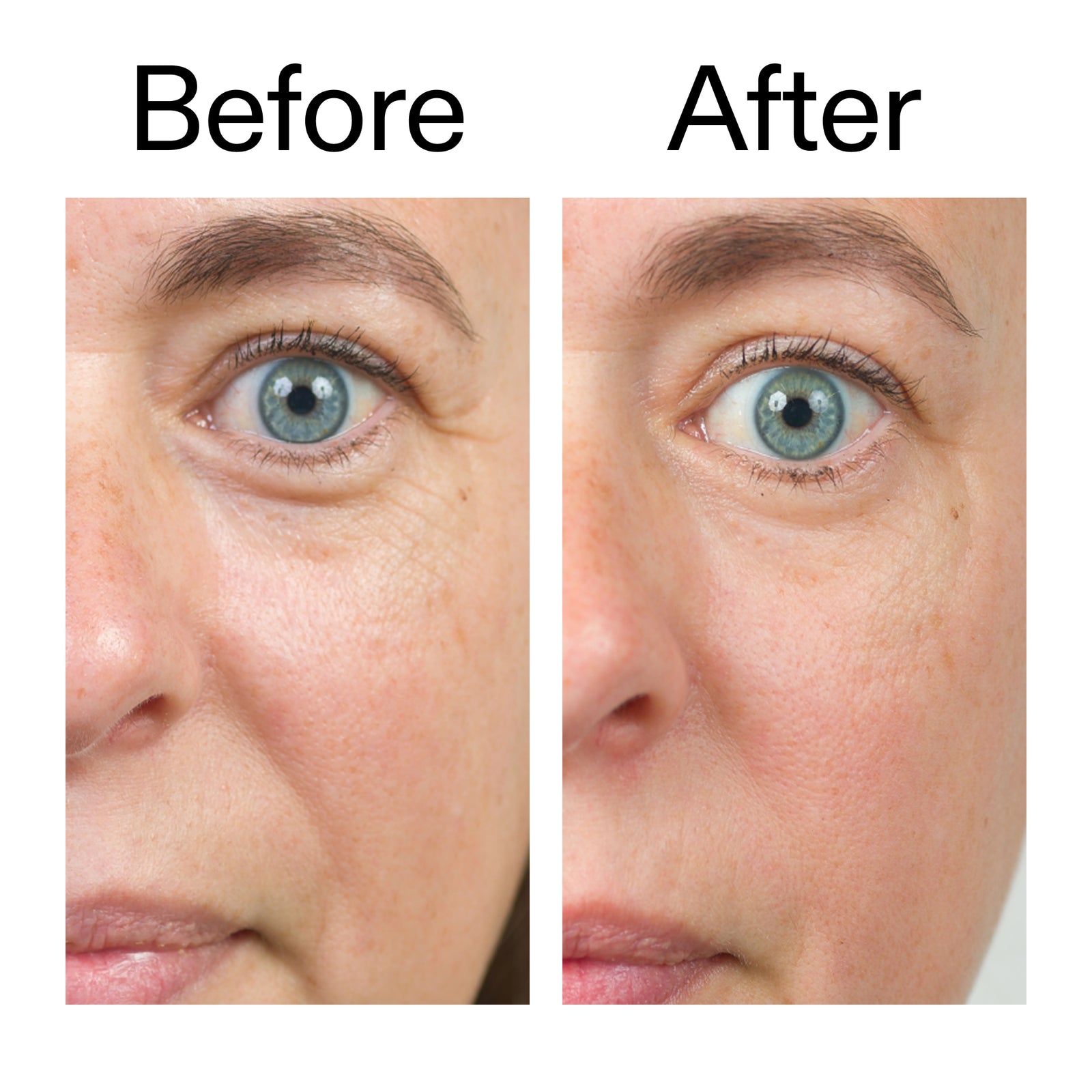 Before and after of customer using BioActive Moisturizer