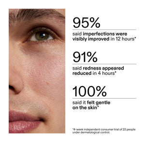 Close-up of a person's face with skincare product application, showing improvement statistics from using Succinic Acid Treatment in a clinical study