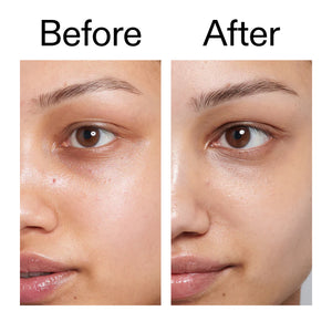 Before and after using Caffeine Eye Cream