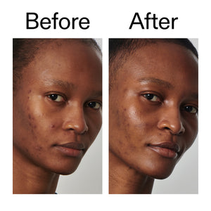 Before and after comparison of a person's face with visible skin texture changes.