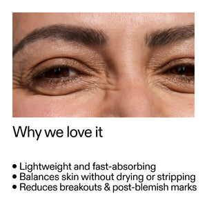 Close-up of a person's eye with text highlighting 20% Niacinamide Serum benefits