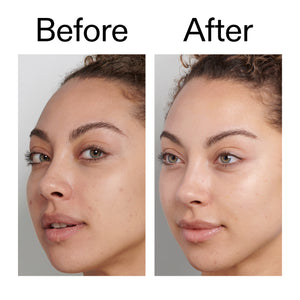 Before and after comparison of a woman's face using Fulvic Acid Cleanser
