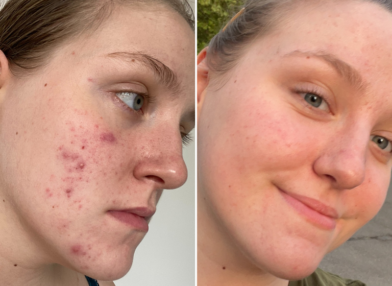 Customer before and after results side by side image