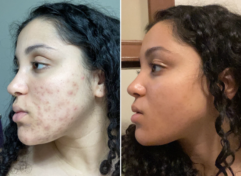 Customer before and after image
