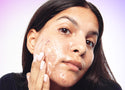9 things you can do to prevent acne