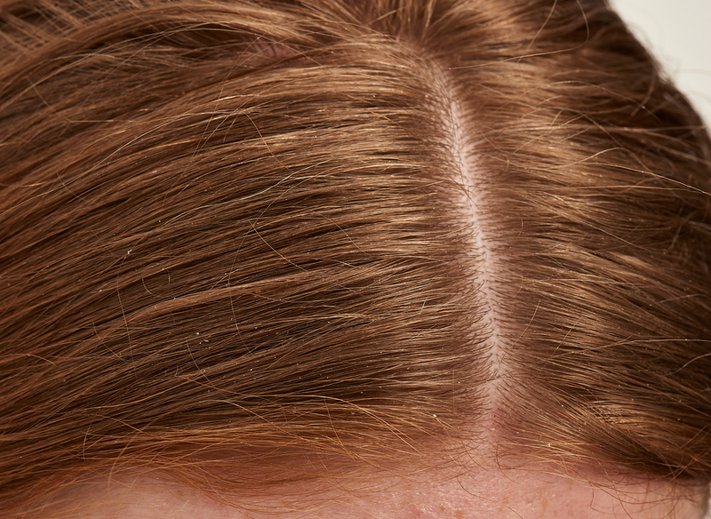 Close up of hair parting