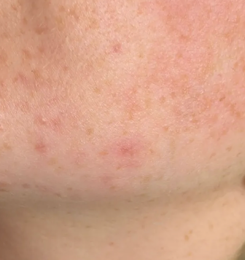 Close up of skin