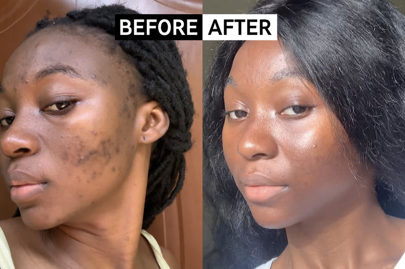 Customer using The INKEY List as part of their skincare routine