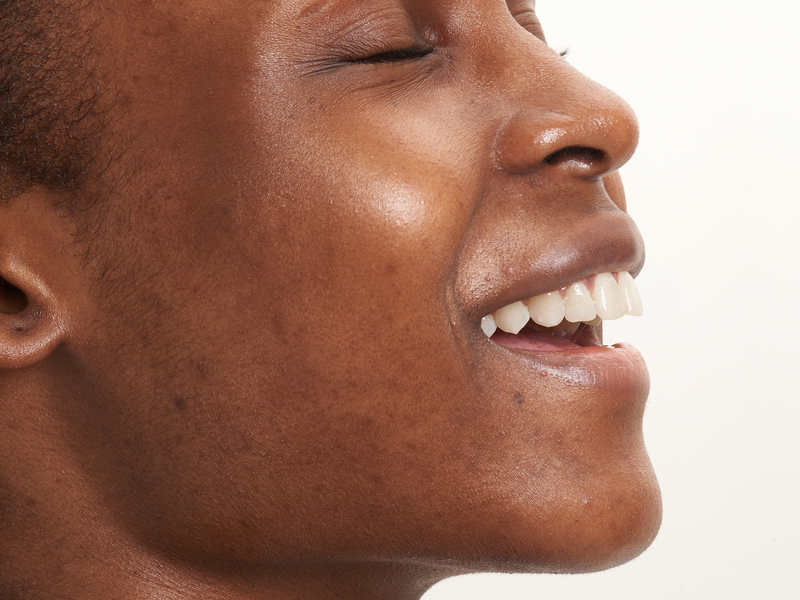 How to Prevent Blackheads Long-Term: The Complete Guide