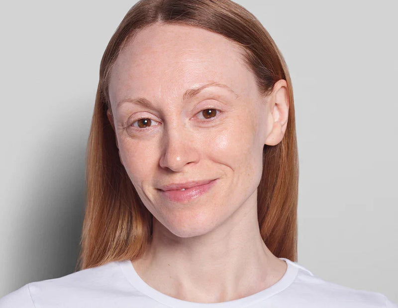 Woman with clear skin