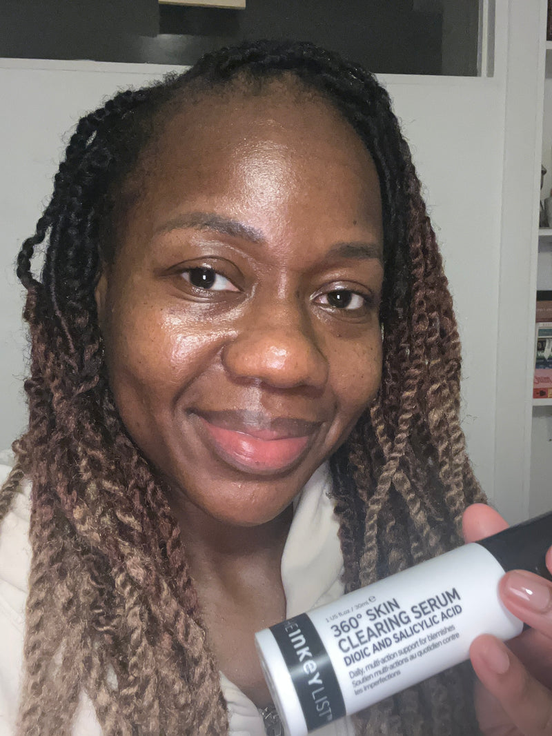 A woman with long hair holds a white and black tube of 360° Skin Clearing Serum in front of her face, showing the product packaging in a close-up selfie-style shot.