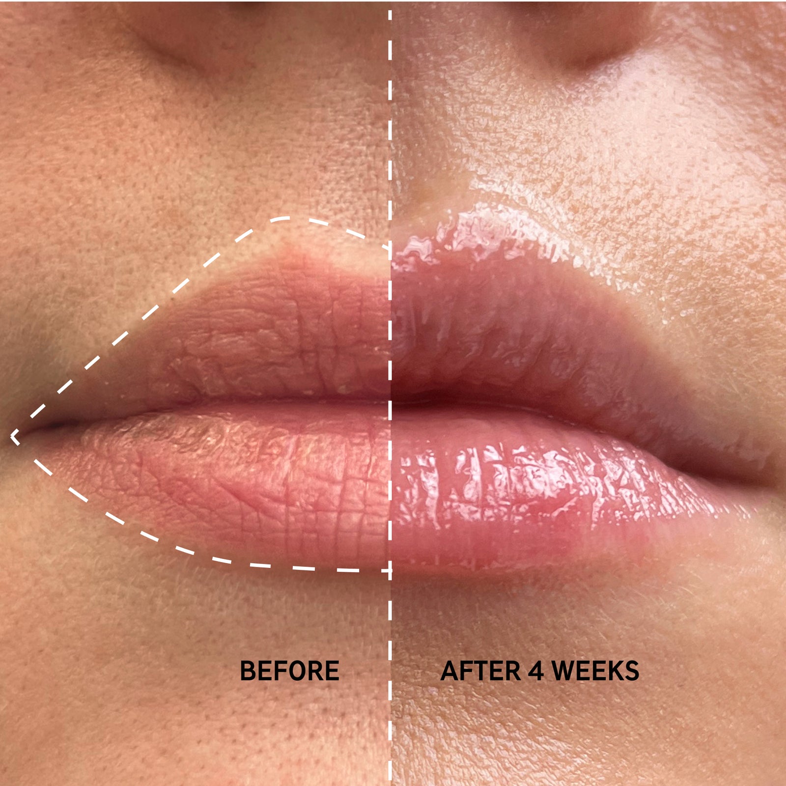 Before and after of Clear Tripeptide Lip Balm showing plumper and smoother lips