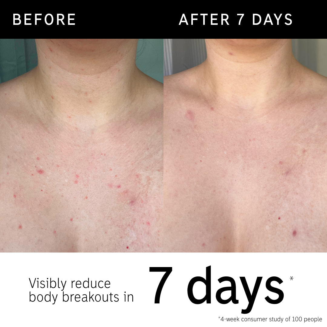 Before and after using Glycolic body stick and key claim from consumer study