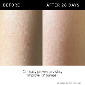 Before and after using Glycolic body stick and key claim from clinical study