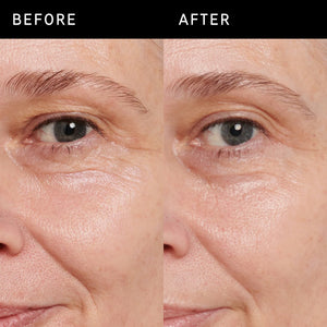 Before and after using Retinol Eye Cream