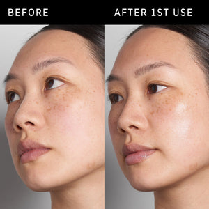 Before and after using Hyaluronic Acid Serum