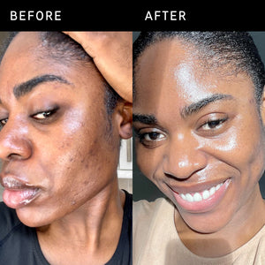 Before and after of using Omega Water Cream