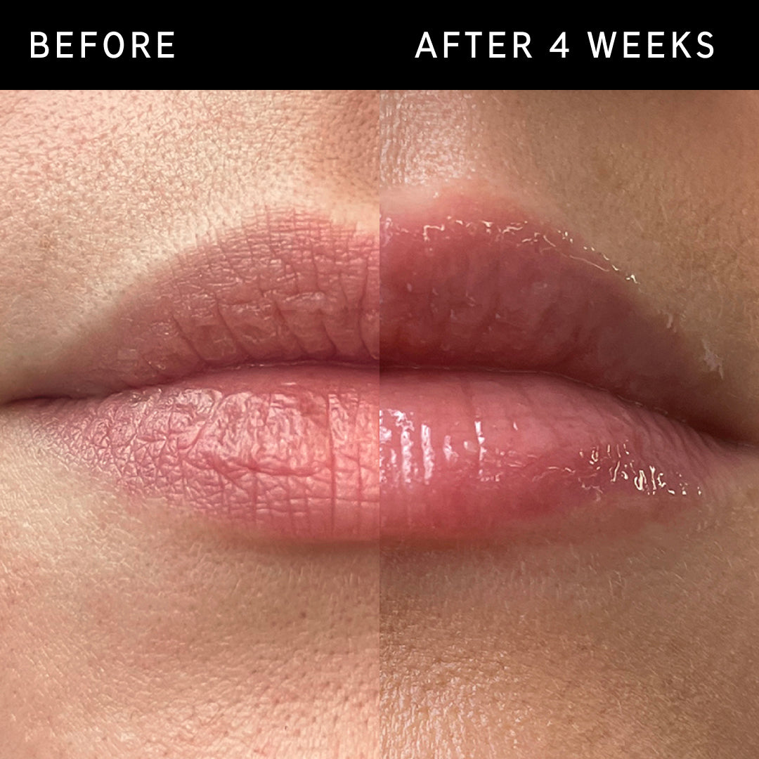 Before and after using Tripeptide Plumping Lip Balm for 4 weeks