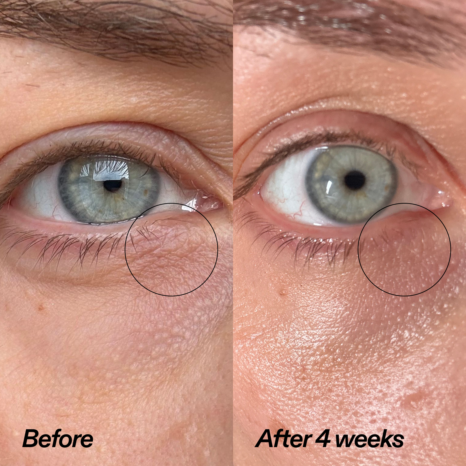 Bio-Active Ceramide Eye Cream Duo