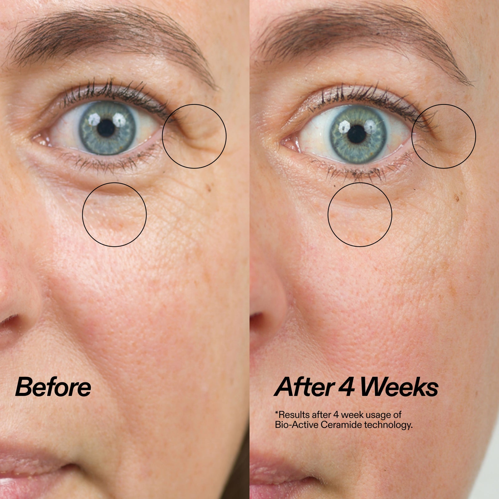 Bio-Active Ceramide Eye Cream Duo