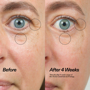 Bio-Active Ceramide Eye Cream Duo