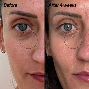 Bio-Active Ceramide Eye Cream Duo