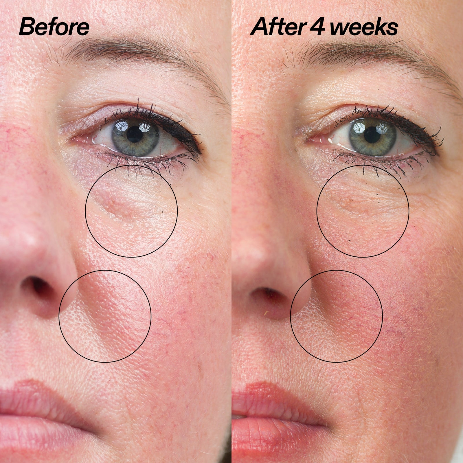Bio-Active Ceramide Moisturizer
