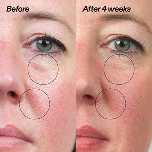 Bio-Active Ceramide Moisturizer