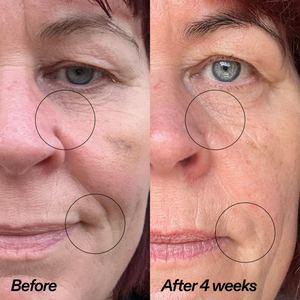 Bio-Active Ceramide Moisturizer