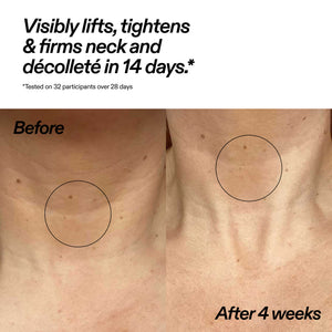 Bio-Active Ceramide Neck Stick Duo