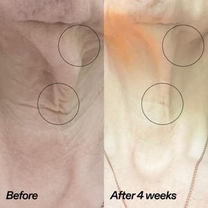 Bio-Active Ceramide Neck Stick Duo