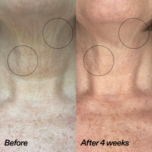 Bio-Active Ceramide Neck Stick Duo