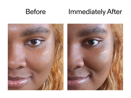 Before and immediately after using Exosome serum
