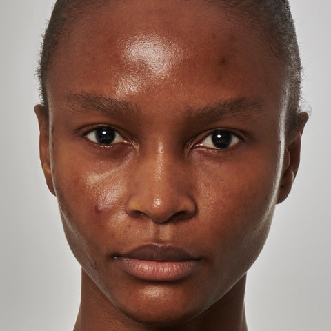 Image of model with excess oil on her face