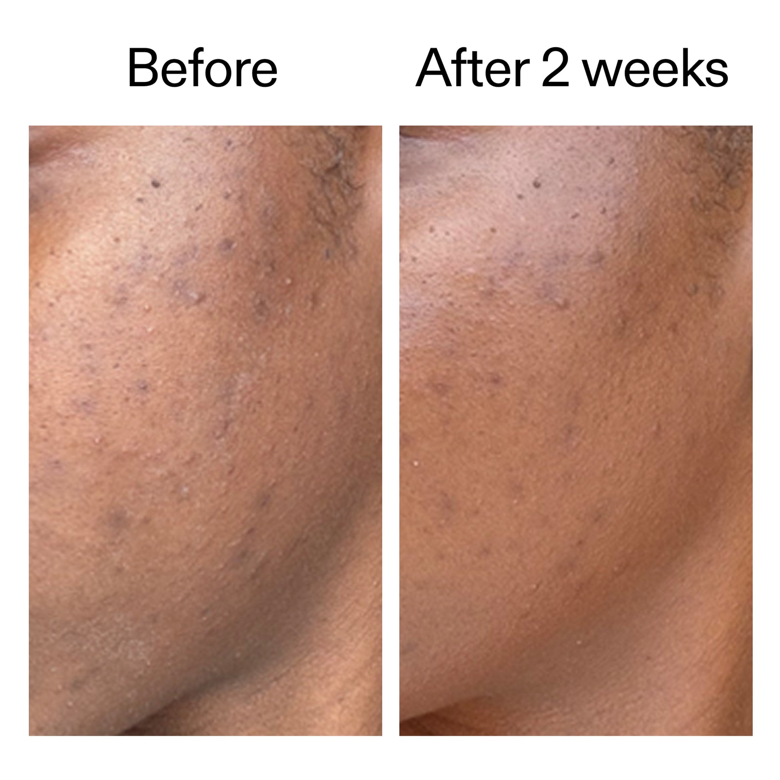 Before and after showing reduced blemishes  