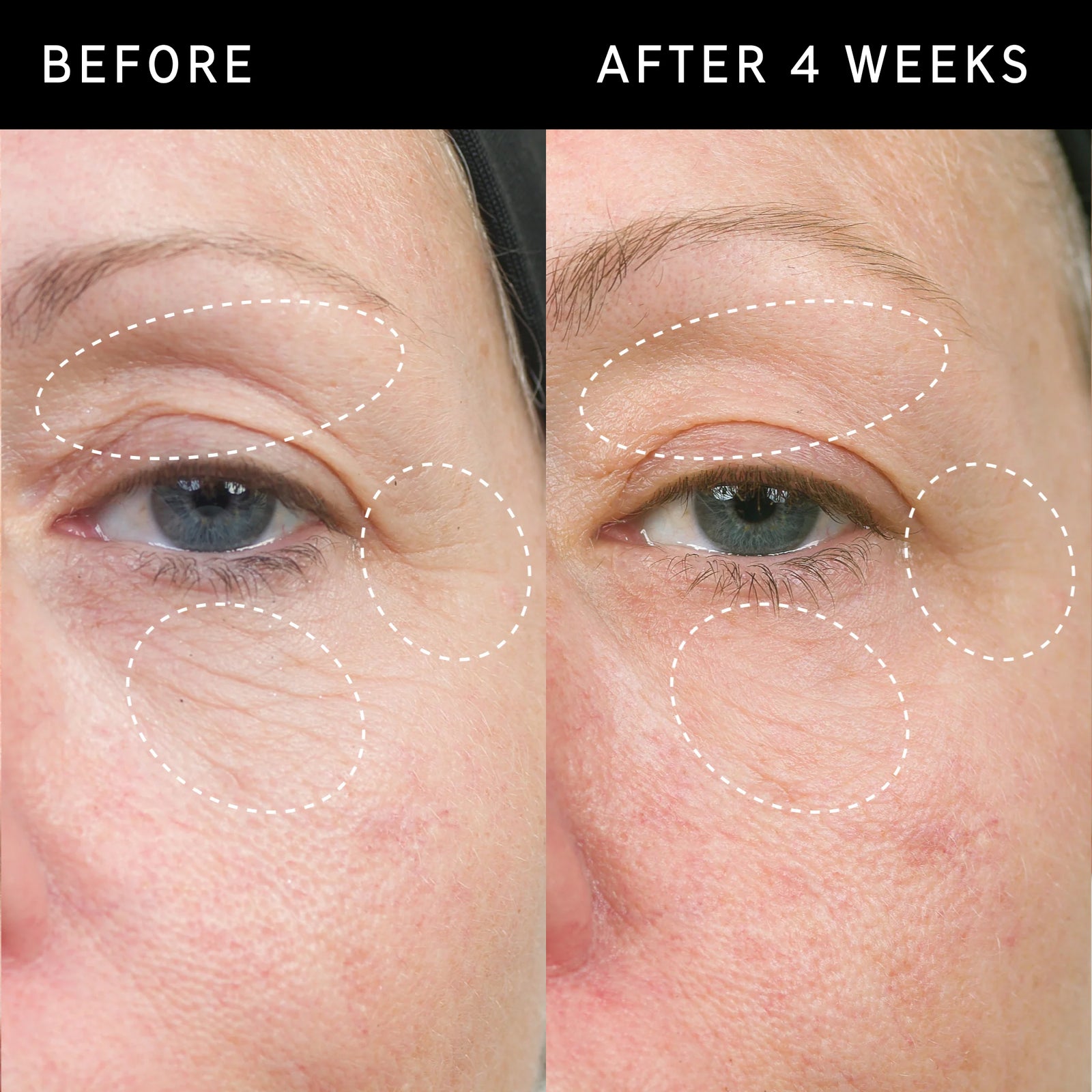 Before and after images to show Bio-Active Ceramide Repairing and Plumping Moisturizer results after 4 weeks