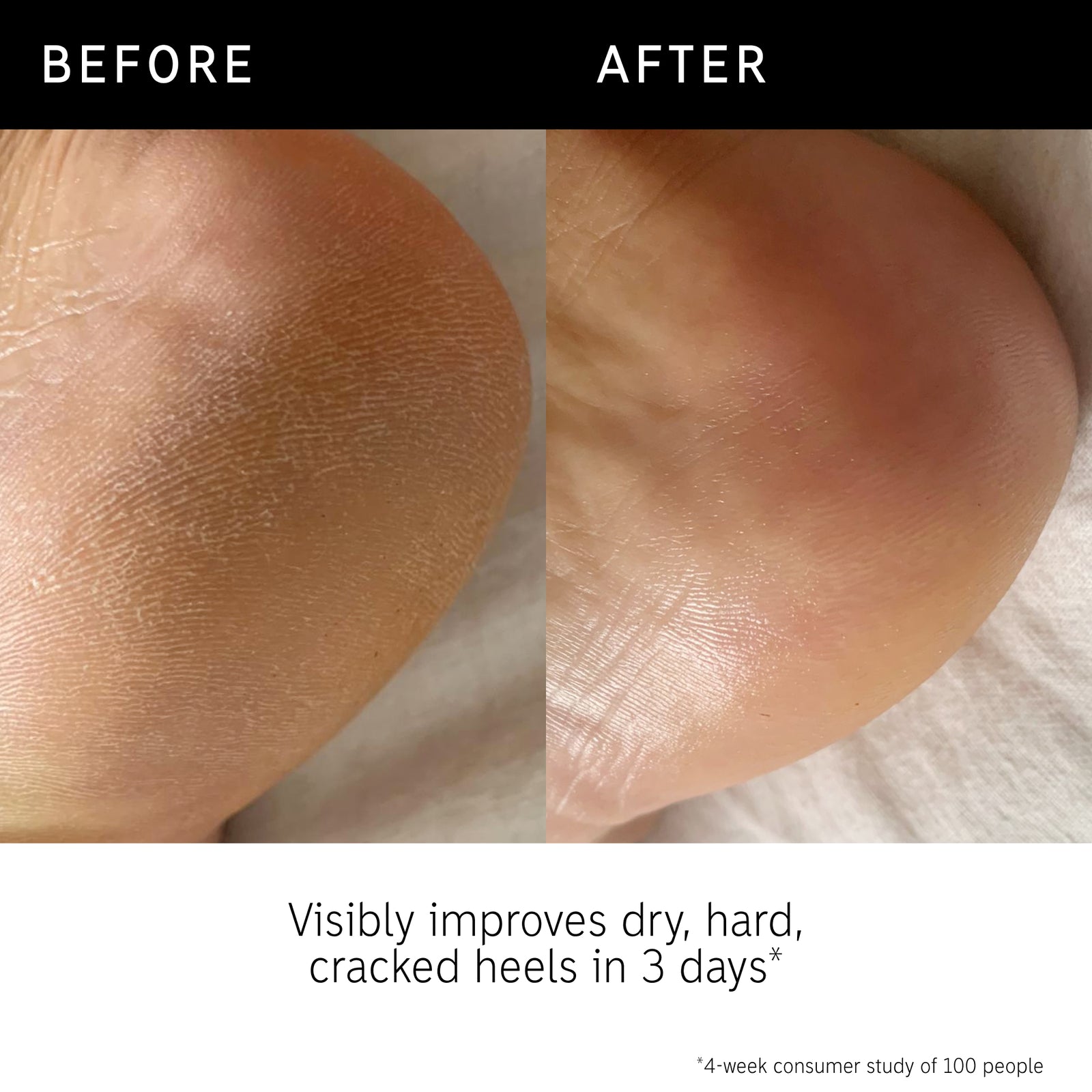 Before and after of using Glycolic Acid Body Stick and key claim from recent consumer trial