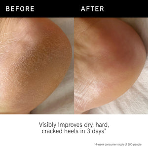 Before and after of using Glycolic Acid Body Stick and key claim from recent consumer trial