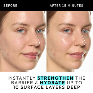 Before and after 15 minutes: Instantly strengthen barrier and hydrated up to 10 surface layers deep