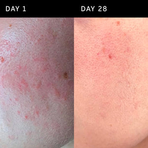 Day 1 vs Day 28, showing reduced redness 