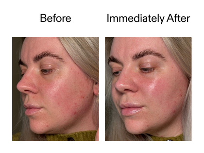 Before and Immediately after using Exoosme serum