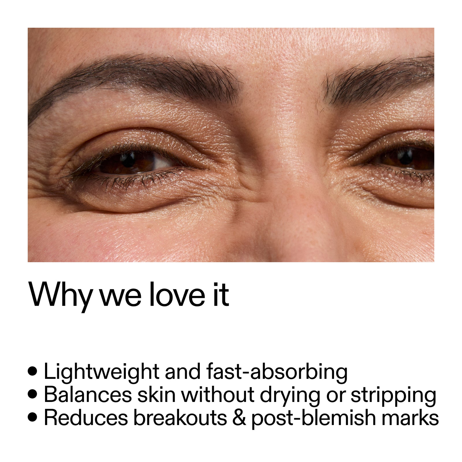 Close-up of a person's eye with text highlighting 20% Niacinamide Serum benefits