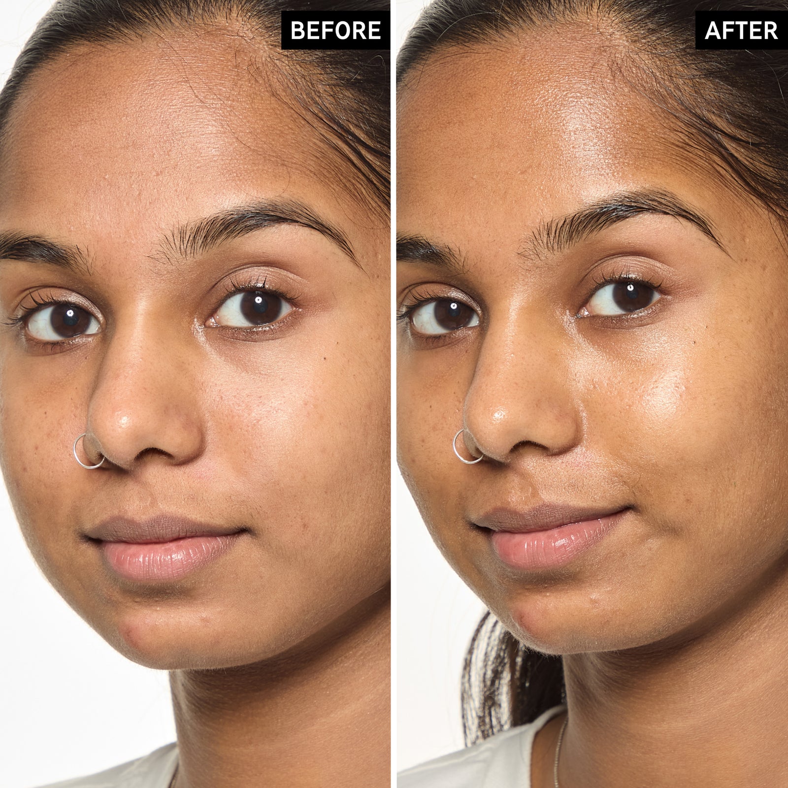 Before and after 14 days showing glowing smooth skin