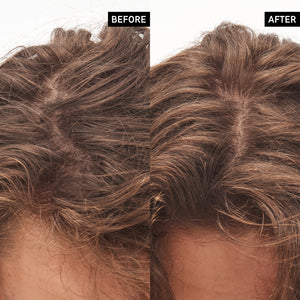 Before and after using Glycolic Acid Exfoliating Scalp Scrub