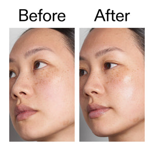 Before and after comparison of a person's face with visible skin treatment results.