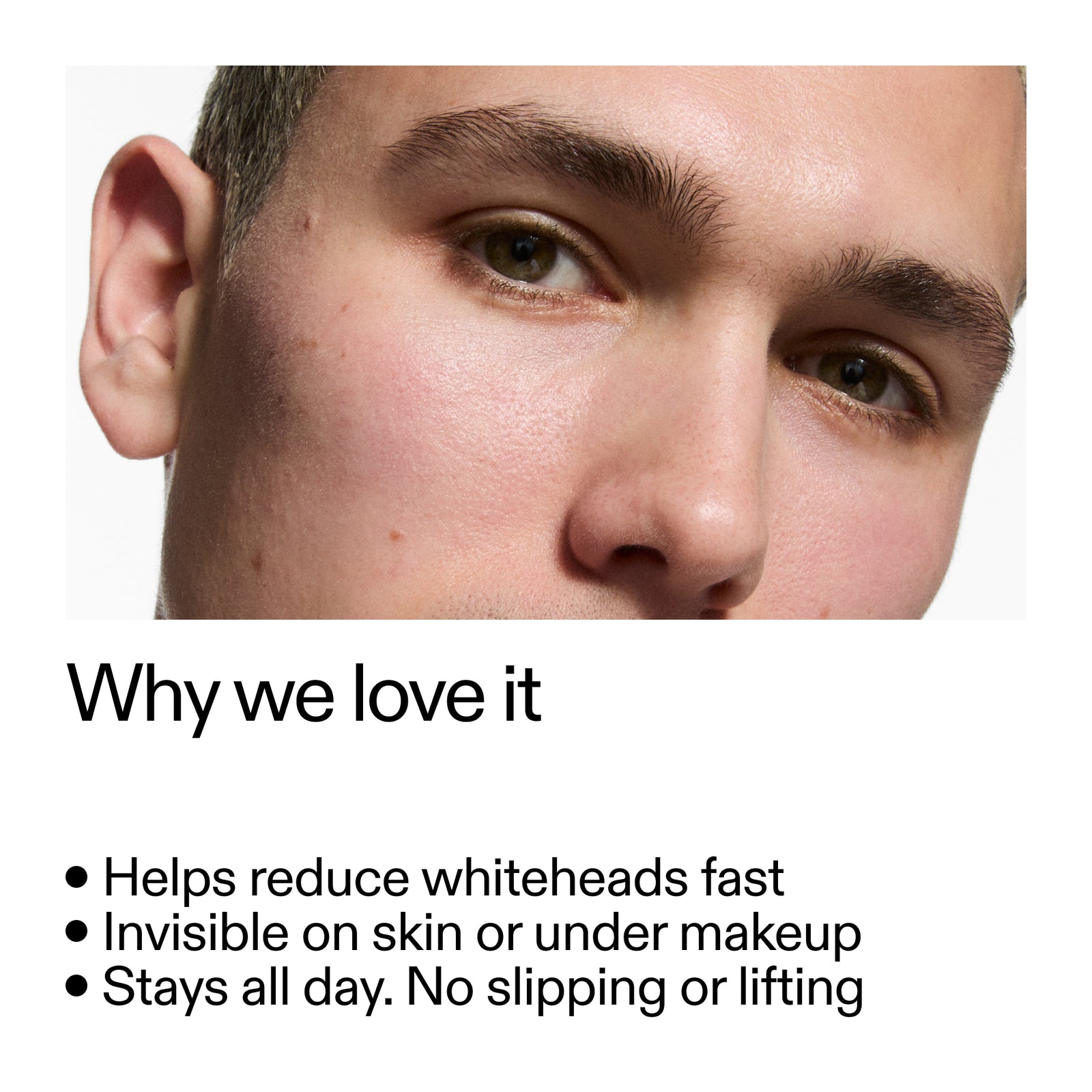 close up of mans face with key benefits of Hydrocolloid Invisible Patches