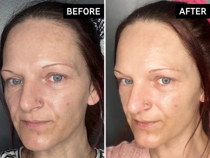 Before and after comparison of a woman's face with visible skin texture differences.