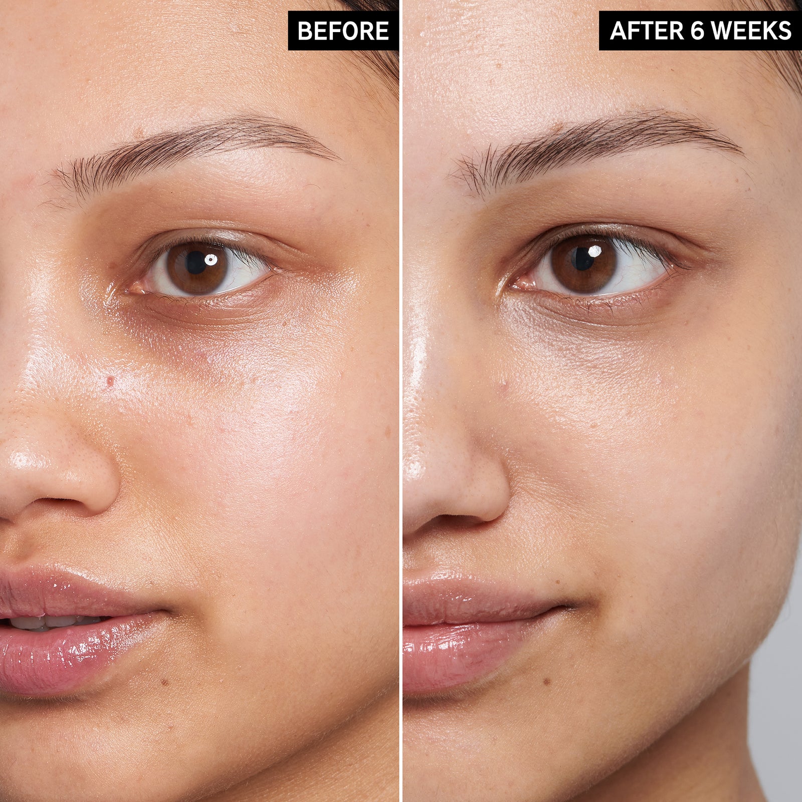 Before and after of using Caffeieien Eye Cream for 6 weeks