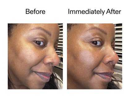 Before and immediately after using Exosome serum