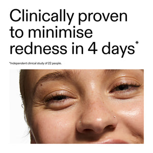 Close-up of a person's eye with text claiming clinical provenance of Azelaic Acid Serum to help  minimize redness in 4 days.